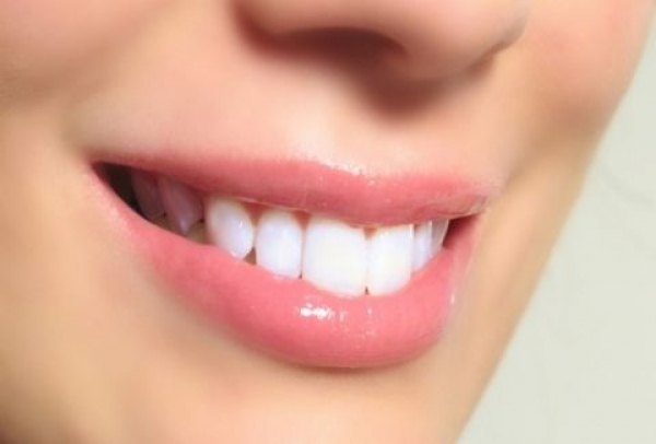 Φυσική λεύκανση: 7 τροφές που χαρίζουν κατάλευκα δόντια